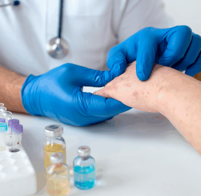 Read more about the article Moderate to Severe Systemic Lupus Erythematosus (J&J)