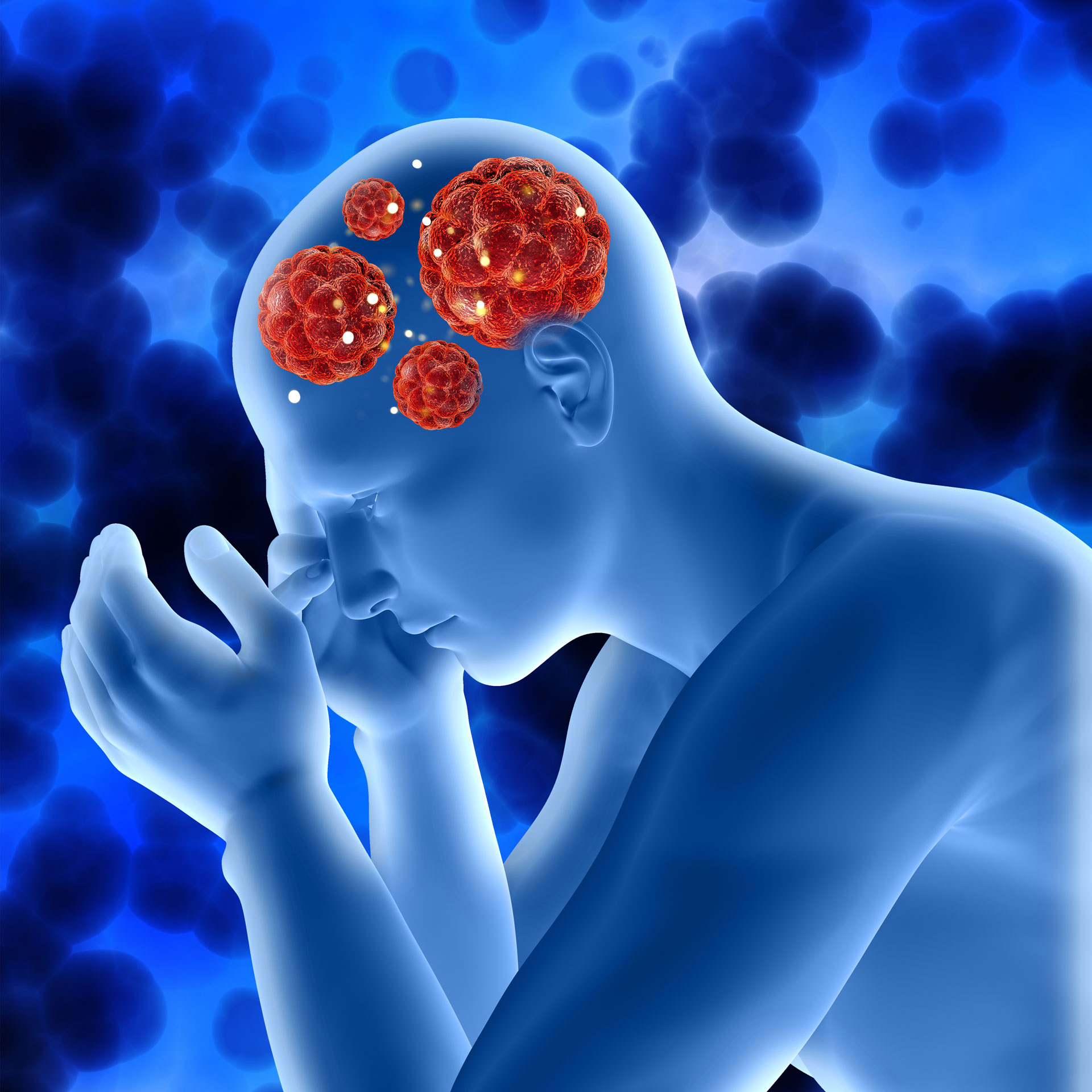 Read more about the article VIMA Therapeutics Isolated Dystonia