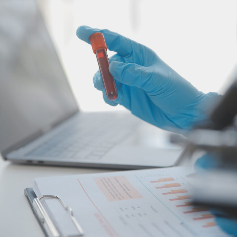 Read more about the article Cinphloro — IBS-D